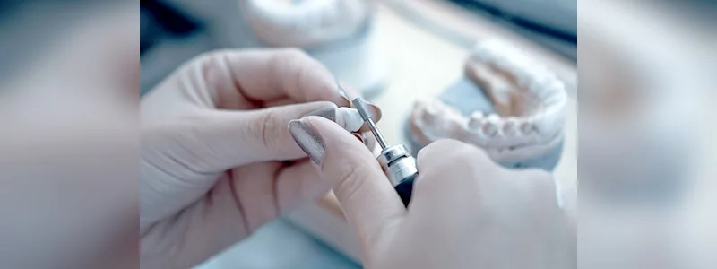 CityDent kurum içi diş laboratuvarı