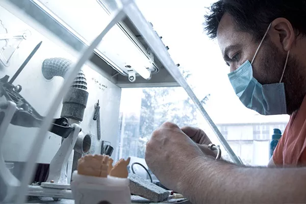 Laboratuvarda hazırlanmış porselen inley ve onley parçaları