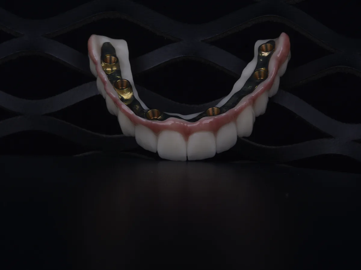 Hekimin vidalı protezi implant dayanağına sabitlemesi