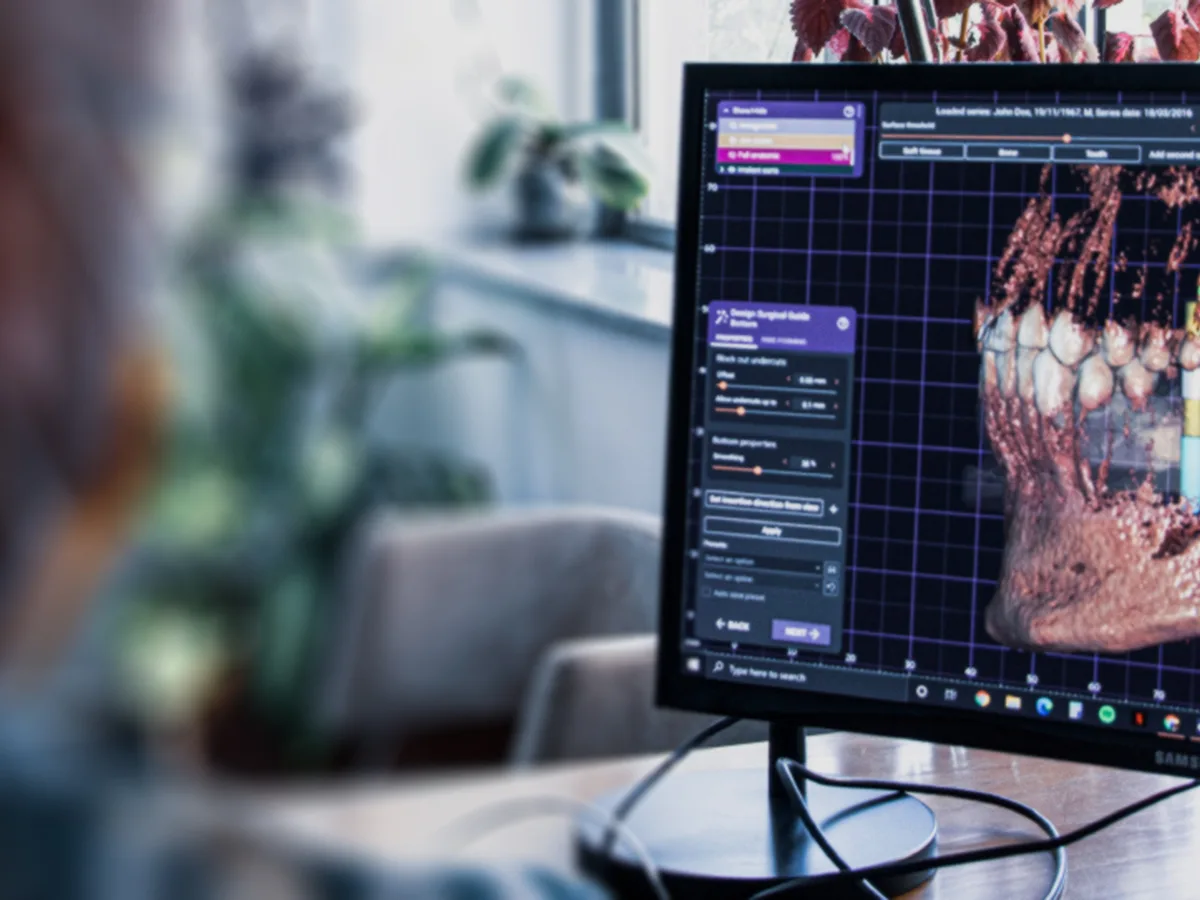 CityDent İstanbul'da CAD/CAM dijital diş hekimliği süreci